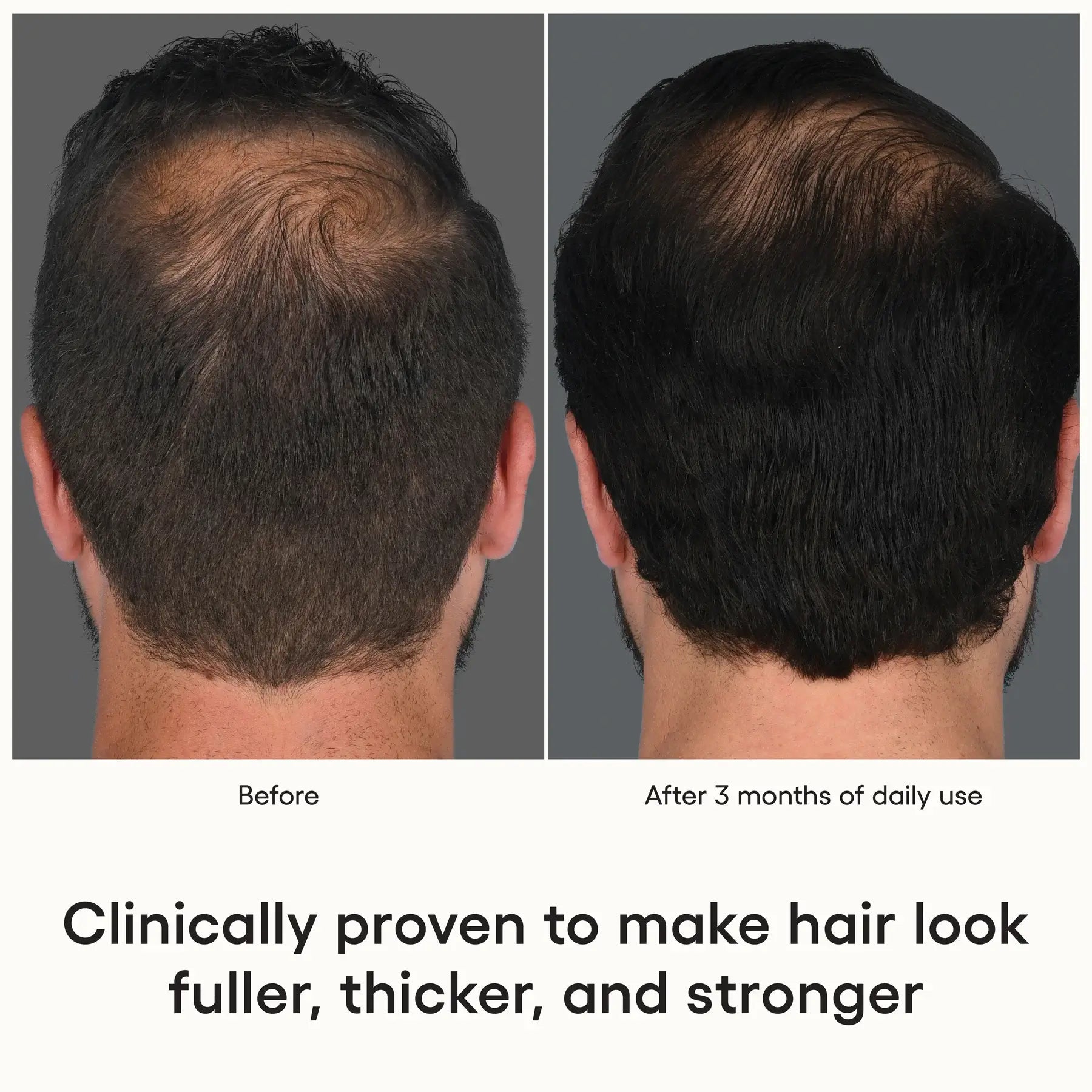 HAIR Serum (1 oz)